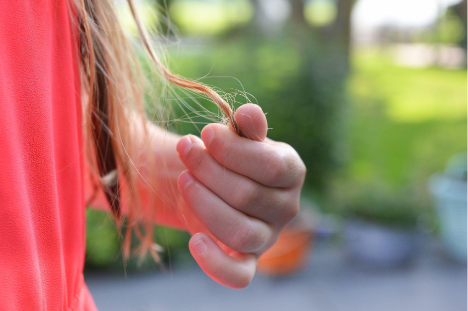 COVID-19 and Hair Loss in Females: What You Should Know
