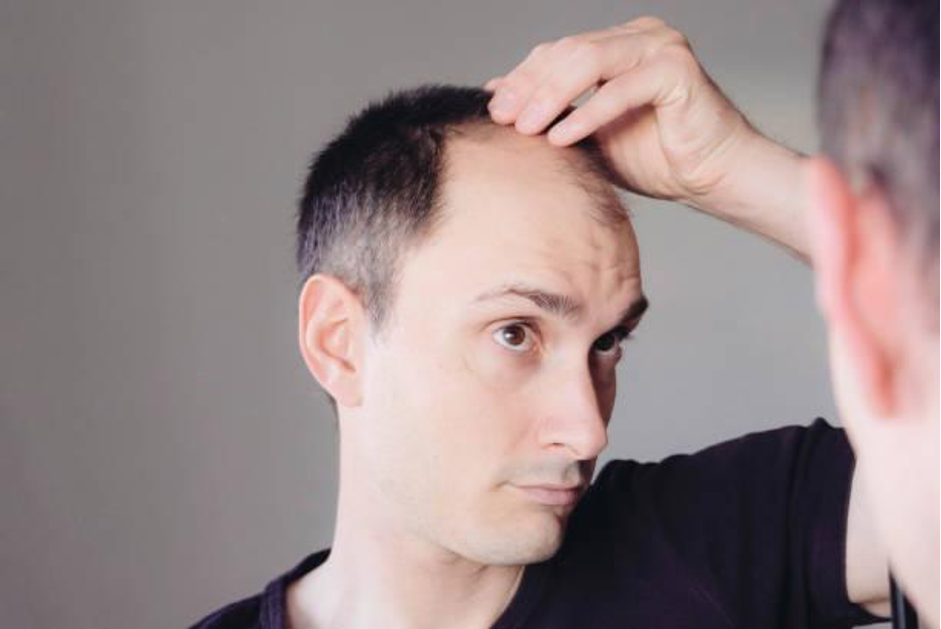Can Vitamin D Deficiency Cause Hair Thinning prothikhairblog